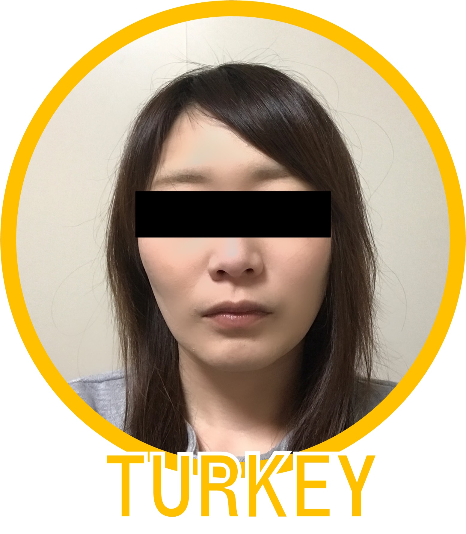 TURKEY